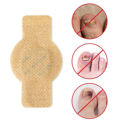 Elaimei™  Fungal Nail Patches