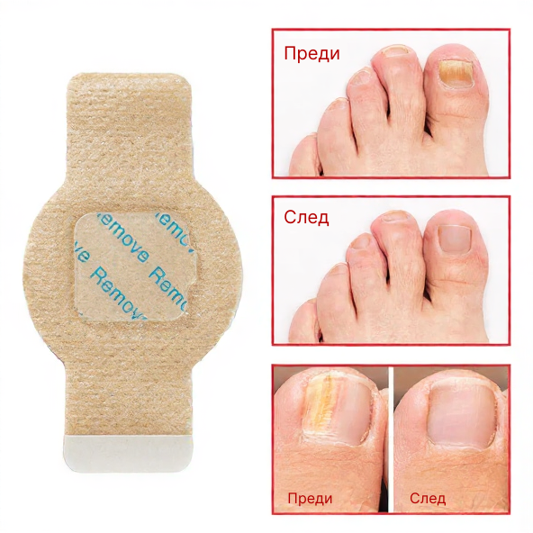 Elaimei™  Fungal Nail Patches