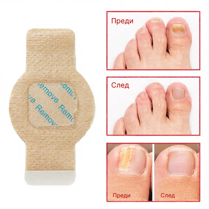 Elaimei™  Fungal Nail Patches
